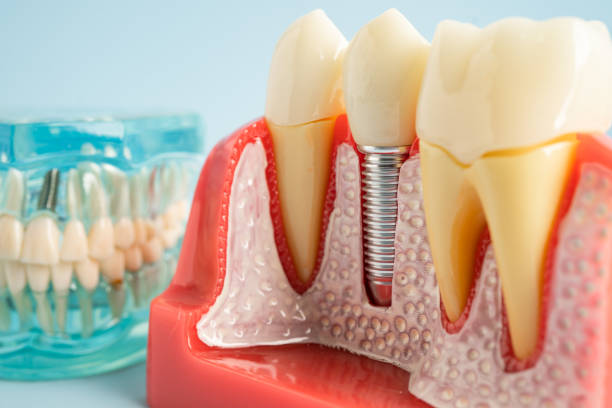 Oral Surgery in Streetsboro, OH